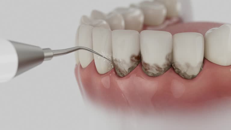 Trusted Tooth Extraction service in Affton, MO - Dentist Open Now